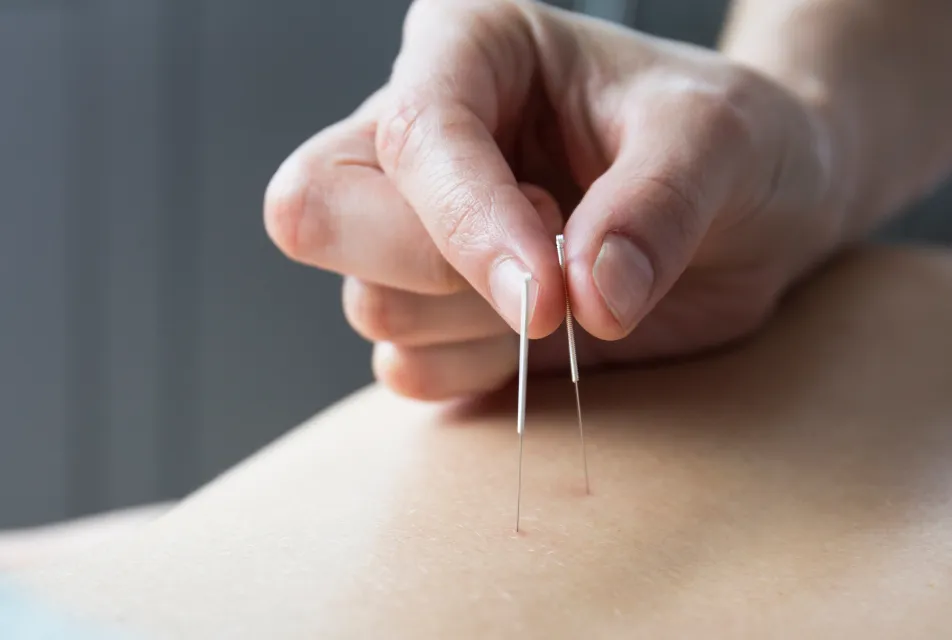 침 치료