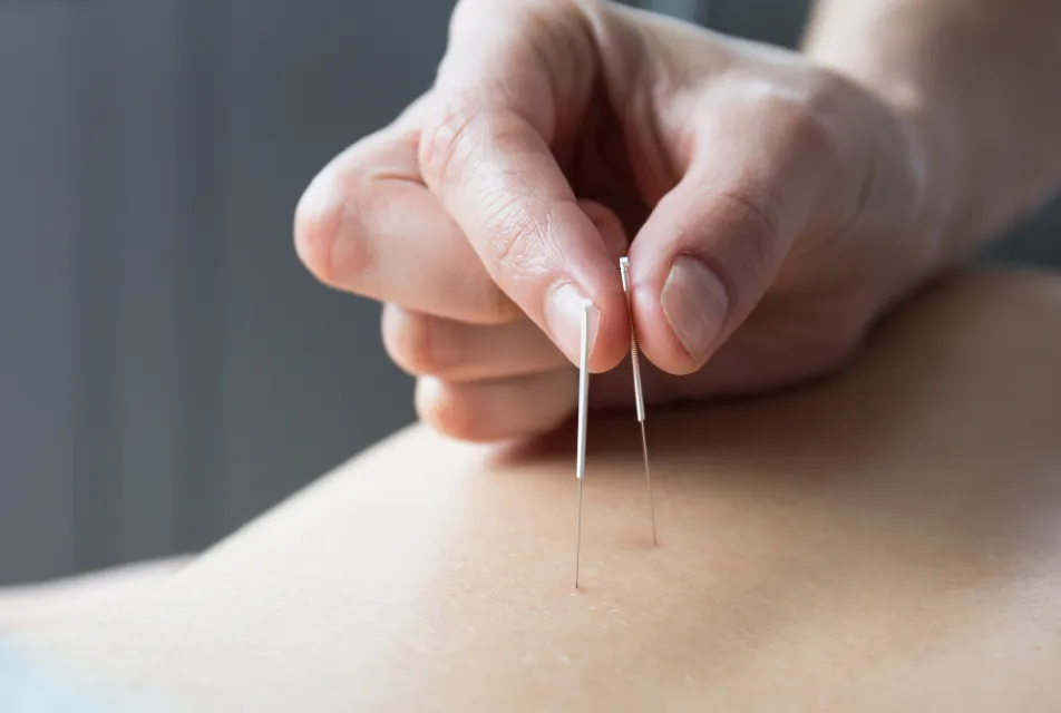 침 치료