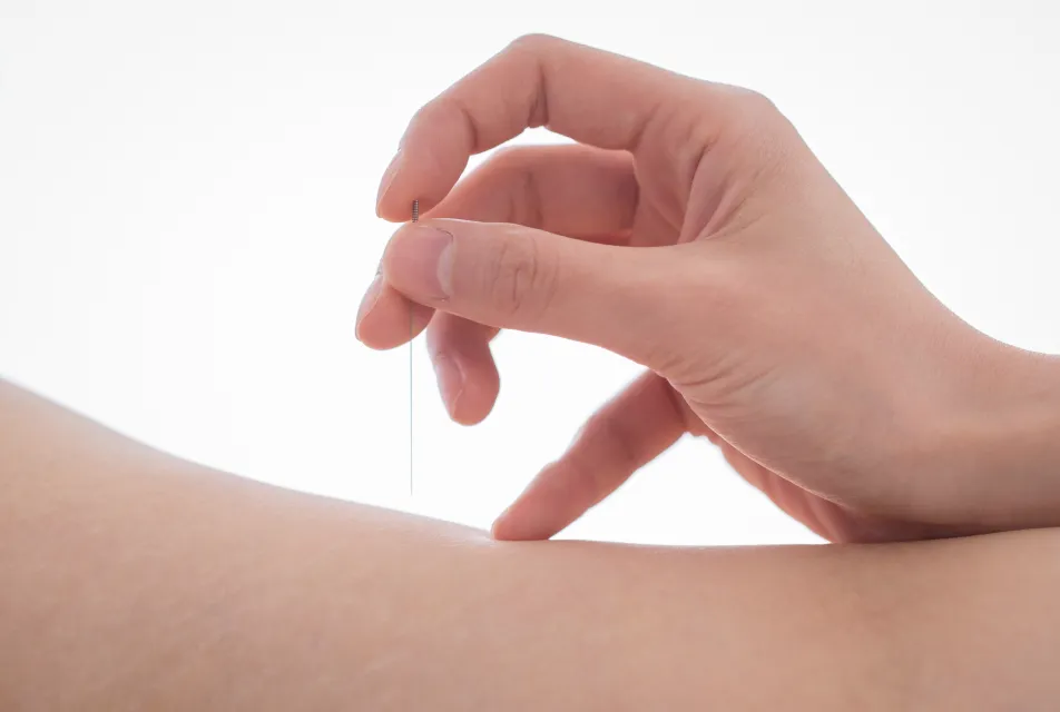 성장판을 직접 자극하는 침 치료