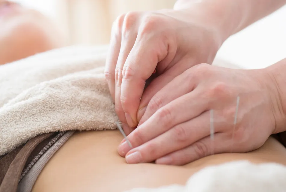 침 치료